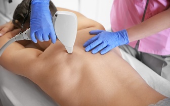 3 Sessões de Depilação a Laser de Díodo para Homem: Peito + Costas + Axilas + Ombros por 65€ em Gondomar!