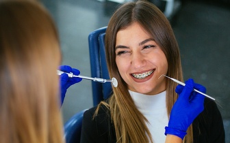 Aparelho Fixo Superior e Inferior + Colocação + Estudo Ortodôntico por 119€ na Trindade!