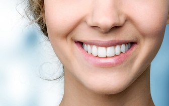 Branqueamento com Luz LED por 79€ em Heroísmo!