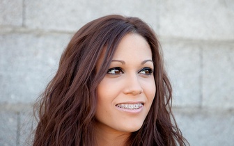 Aparelho Fixo Metálico + Branqueamento Dentário por 59€ em Telheiras!